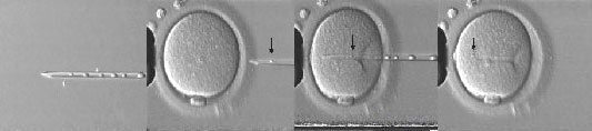 ICSI - Intracytoplasmic Sperm Injection, LifeStart Fertility Center 